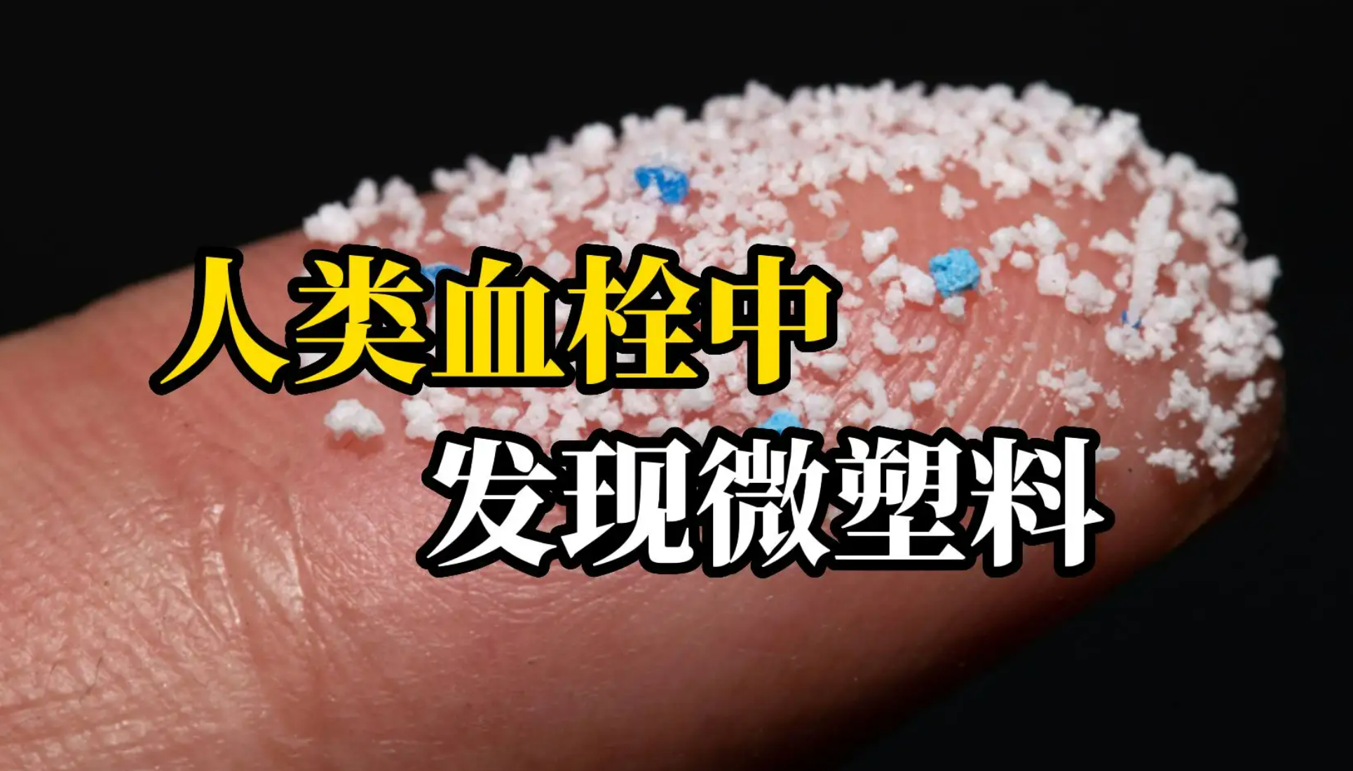 震驚！人類血栓中首次發現微塑料（liào）！